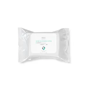 Acne Cleansing Wipes, Suitable for Oily or Acne-Prone Skin - by SUZANOBAGIMD - Pack of 25 Wipes