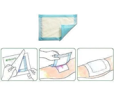 Mesorb Cellulose Absorbent Dressings 20cm x 30cm x10 - Highly Absorbant